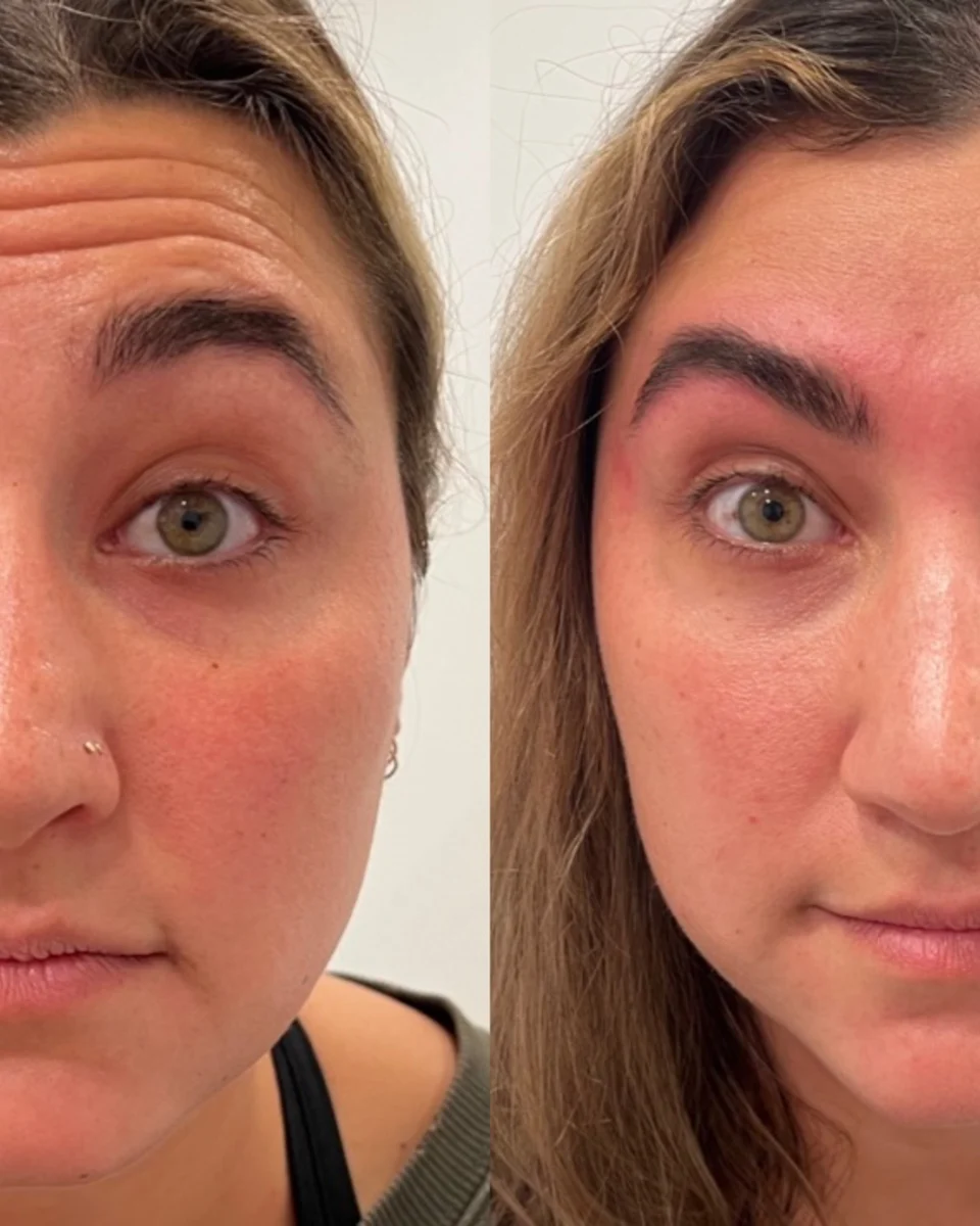 Back to 30 treatment results