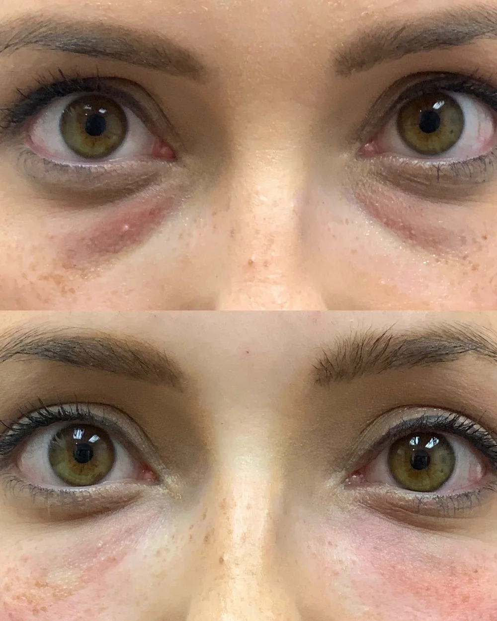 A Back to 30 patient in Upstate South Carolina