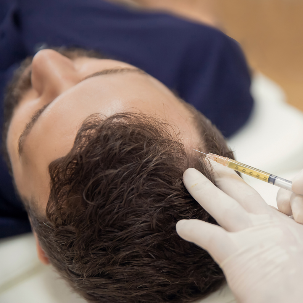 PRP Hair Loss Treatment