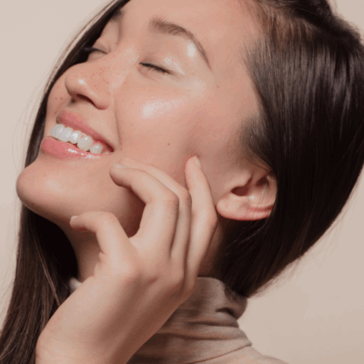 IPL Photorejuvenation South Carolina