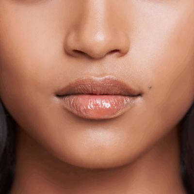 Dermal Fillers Face
