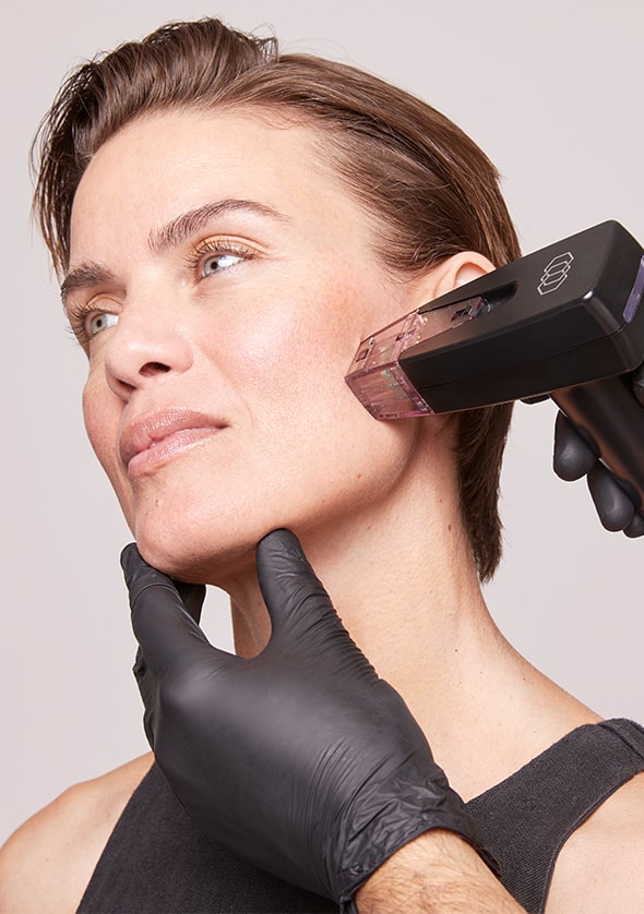 morpheus8 for face