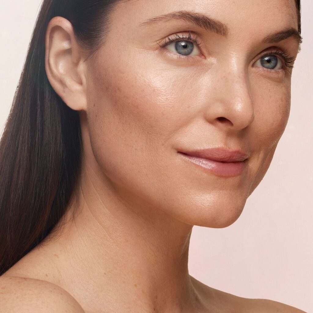 Ultherapy Treatment Results