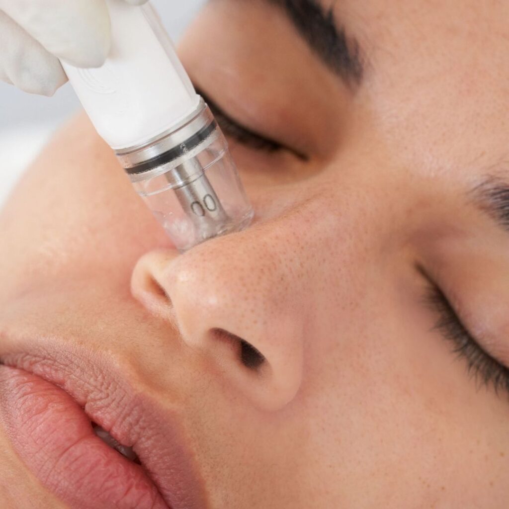 Diamondglow Treatments