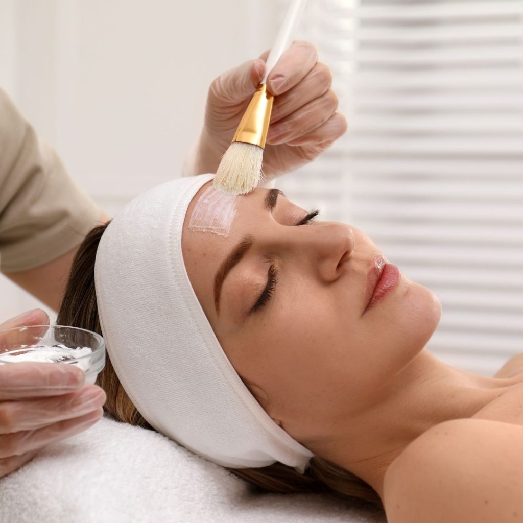 chemical peel process
