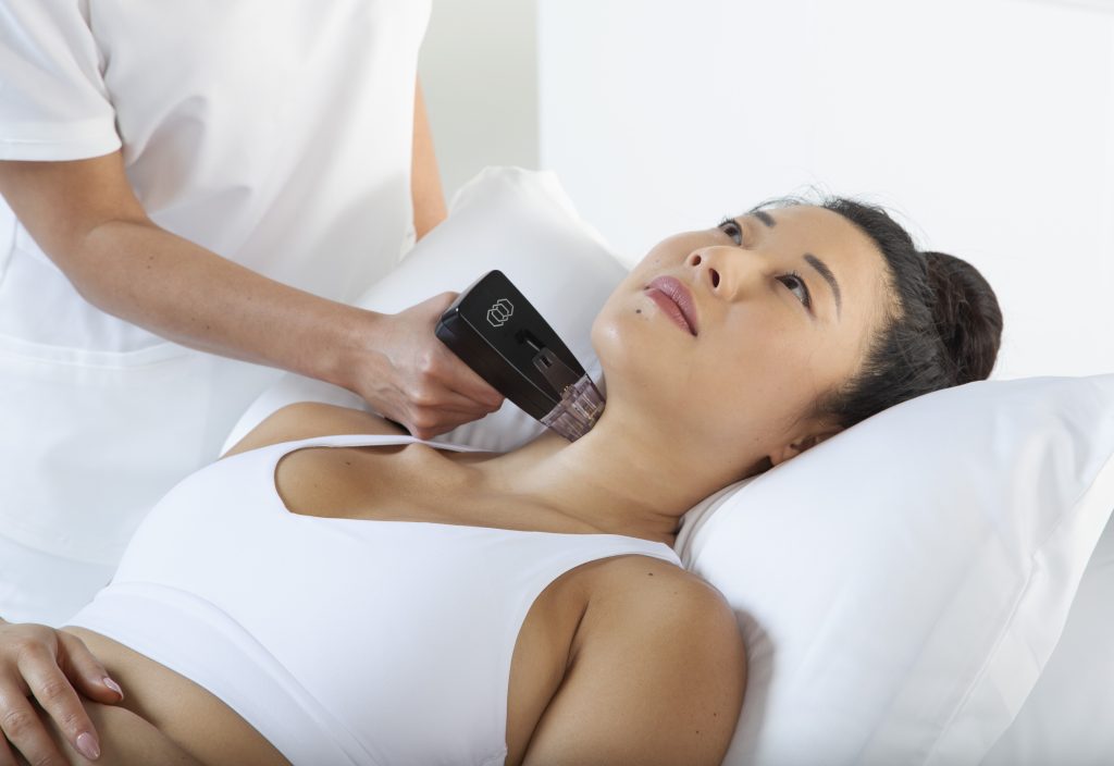 Morpheus8 Treatment