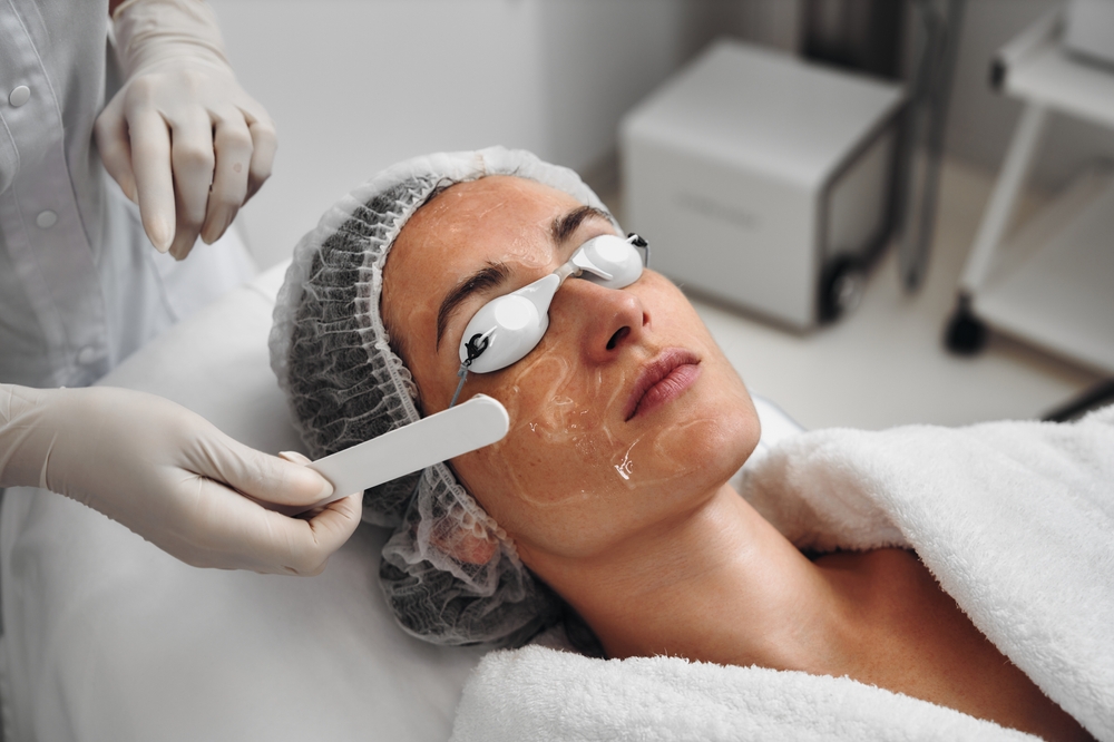 Lumecca IPL Treatment