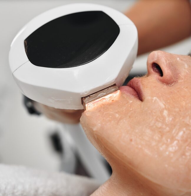 IPL Treatment Process